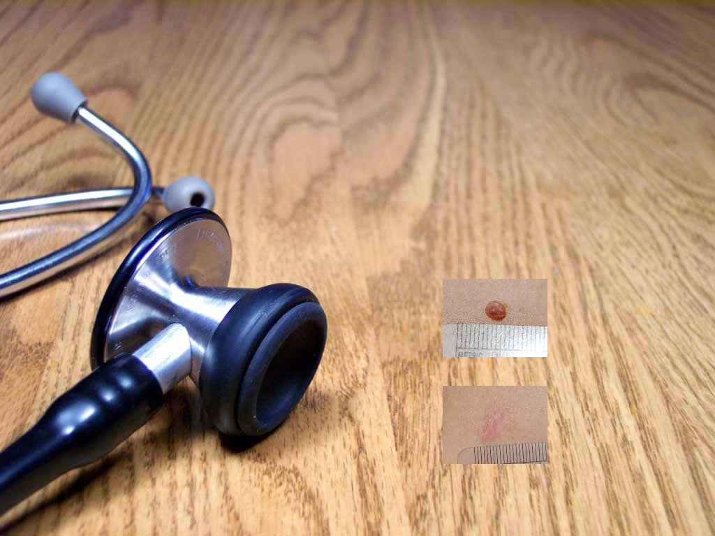 copyright 2005 Mark Vaughan, M.D.